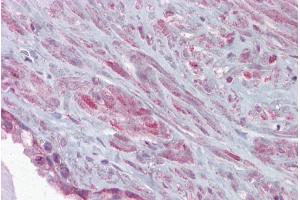 Immunohistochemistry with Prostate tissue at an antibody concentration of 5µg/ml using anti-KCNMA1 antibody (ARP35092_P050) (KCNMA1 抗体  (C-Term))