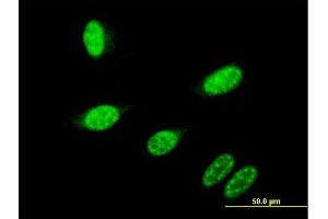 Immunofluorescence of monoclonal antibody to GBX2 on HeLa cell. (GBX2 抗体  (AA 114-182))