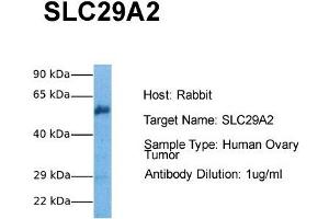 Host: Rabbit Target Name: SLC29A2 Sample Tissue: Human Ovary Tumor Antibody Dilution: 1.