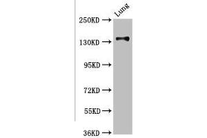 MAN2B2 Antikörper  (AA 347-523)