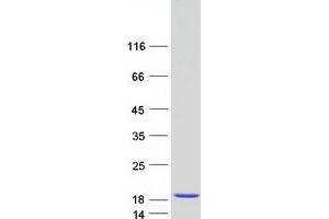 Validation with Western Blot