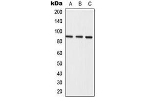 Western blot analysis of Semaphorin 3E expression in A549 (A), mouse liver (B), rat liver (C) whole cell lysates. (SEMA3E 抗体  (Center))