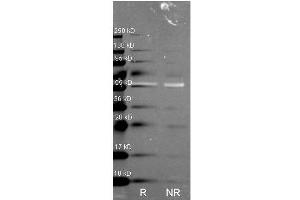 Western Blot of Rabbit anti-Catalase antibody. (Catalase 抗体)