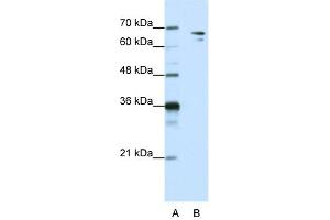 WB Suggested Anti-SF1 Antibody Titration:  1.