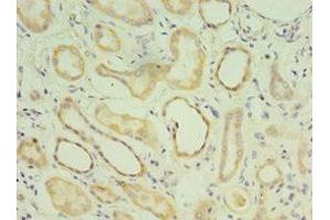Immunohistochemistry of paraffin-embedded human kidney tissue using ABIN7159049 at dilution of 1:100 (Matrilin 3 抗体  (AA 277-486))