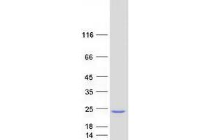 Western Blotting (WB) image for S-Phase Kinase-Associated Protein 1 (SKP1) (Transcript Variant 2) protein (Myc-DYKDDDDK Tag) (ABIN2732123)