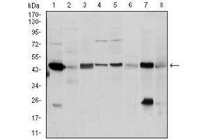 Western blot analysis using ASS1 mouse mAb against A431 (1), RAJI (2), MOLT4 (3), Jurkat (4), A549 (5), NIH/3T3 (6), PC-12 (7) and Cos7 (8) cell lysate. (ASS1 抗体)