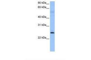 Image no. 1 for anti-Rhophilin Associated Tail Protein 1 (ROPN1) (AA 39-88) antibody (ABIN6738784) (ROPN1 抗体  (AA 39-88))