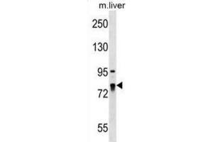 Western Blotting (WB) image for anti-La Ribonucleoprotein Domain Family, Member 4 (LARP4) antibody (ABIN2999557) (LARP4 抗体)