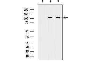 anti-Glutamate Receptor, Ionotropic, AMPA 3 (GRIA3) (C-Term) antibody