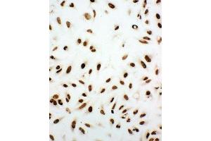 Anti-Ku80 antibody, ICC ICC: HELA Cell