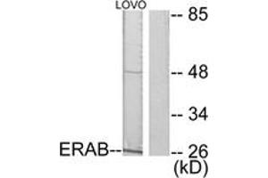 Western blot analysis of extracts from LOVO cells, using ERAB Antibody. (HSD17B10 抗体  (AA 111-160))