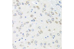 Immunohistochemistry of paraffin-embedded rat brain using PIAS3 antibody at dilution of 1:100 (40x lens). (PIAS3 抗体)