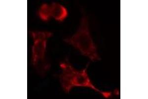 ABIN6275414 staining Hela cells by IF/ICC. (PPM1L 抗体  (Internal Region))