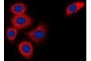 Immunofluorescent analysis of DOK1 staining in K562 cells. (DOK1 抗体)