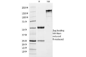 SDS-PAGE Analysis Purified Growth Hormone Monoclonal Antibody (SPM106). (Growth Hormone 1 抗体  (AA 58-187))