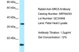Western Blotting (WB) image for anti-Origin Recognition Complex, Subunit 5 (ORC5) (C-Term) antibody (ABIN2789793) (ORC5 抗体  (C-Term))