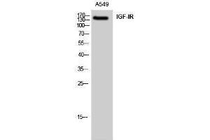 Western Blotting (WB) image for anti-Insulin-Like Growth Factor 1 Receptor (IGF1R) (Ser528) antibody (ABIN3185141) (IGF1R 抗体  (Ser528))