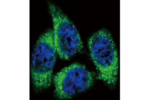 Immunofluorescence (IF) image for anti-Cytochrome P450, Family 17, Subfamily A, Polypeptide 1 (CYP17A1) (AA 358-388) antibody (ABIN392362)