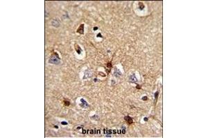 Immunohistochemistry (Paraffin-embedded Sections) (IHC (p)) image for anti-Peroxiredoxin 6 (PRDX6) (AA 197-224), (C-Term) antibody (ABIN389471)