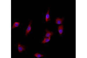 ABIN6266079 and ABIN6272868 staining HepG2 by IF/ICC.