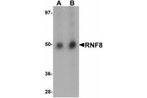 Image no. 1 for anti-Ring Finger Protein 8 (RNF8) (C-Term) antibody (ABIN478298) (RNF8 抗体  (C-Term))