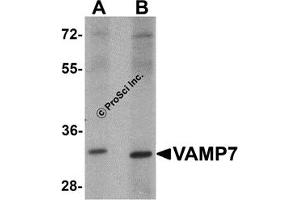 Western Blotting (WB) image for anti-Vesicle-Associated Membrane Protein 7 (VAMP7) antibody (ABIN1031804) (VAMP7 抗体)