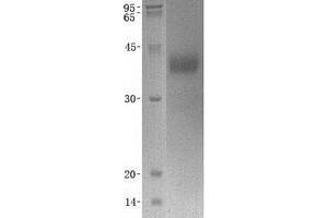 Western Blotting (WB) image for Kallikrein 5 (KLK5) (Transcript Variant 2) protein (His tag) (ABIN2724324)