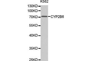 Western blot analysis of extracts of K562 cell lines, using CYP2B6 antibody. (CYP2B6 抗体)