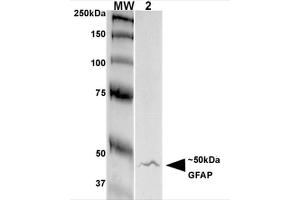 Western Blot analysis of Rat Brain Membrane showing detection of GFAP protein using Mouse Anti-GFAP Monoclonal Antibody, Clone S206A-8 . (GFAP 抗体  (AA 411-422) (APC))