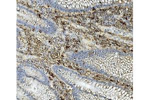 IHC analysis of ASAH1 using anti-ASAH1 antibody (ABIN7602206). (ASAH1 抗体  (AA 63-393))