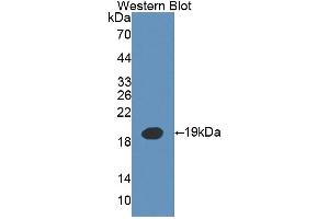 Detection of Recombinant IL3, Mouse using Polyclonal Antibody to Interleukin 3 (IL3) (IL-3 抗体  (AA 33-166))