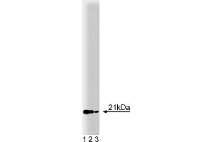 Western Blotting (WB) image for anti-Retinol Binding Protein 4, Plasma (RBP4) (AA 1-135) antibody (ABIN967847) (RBP4 抗体  (AA 1-135))