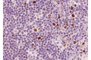 ABIN6267598 at 1/100 staining human Lymphoma tissue sections by IHC-P.