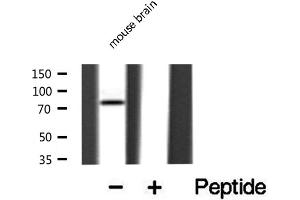 Western blot analysis of extracts from mouse Brian, using DCLK2 antibody. (DCLK2 抗体  (N-Term))