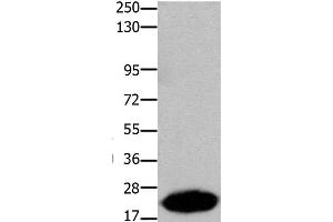 Western Blot analysis of Human liver cancer tissue using Claudin 7 Polyclonal Antibody at dilution of 1:1050 (Claudin 7 抗体)
