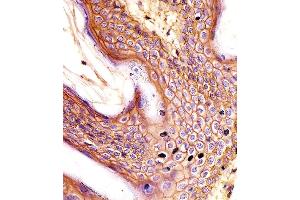 (ABIN659120 and ABIN2843760) staining CD44 in human skin tissue sections by Immunohistochemistry (IHC-P - paraformaldehyde-fixed, paraffin-embedded sections). (CD44 抗体)