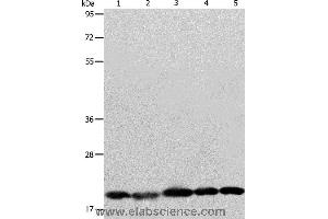 Western blot analysis of Human brain malignant glioma tissue, MCF7, Raji, Lovo and 293T cell, using BAX Polyclonal Antibody at dilution of 1:426 (BAX 抗体)