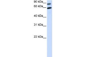 WB Suggested Anti-DVL2 Antibody Titration:  0. (DVL2 抗体  (N-Term))