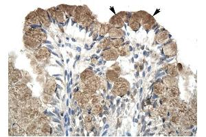 NCOR1 antibody was used for immunohistochemistry at a concentration of 4-8 ug/ml to stain Epithelial cells of intestinal villus (arrows) in Human Intestine.