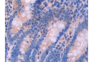 Used in DAB staining on fromalin fixed paraffin- embedded testis tissue (Renin 抗体  (AA 144-237))