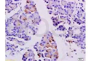 Formalin-fixed and paraffin embedded rat pancreas labeled with Anti-SGCB/SGC Polyclonal Antibody, Unconjugated (ABIN738051) at 1:200 followed by conjugation to the secondary antibody and DAB staining.