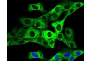 Immunofluorescence (IF) image for anti-Glycyl-tRNA Synthetase (GARS) antibody (ABIN7261389)