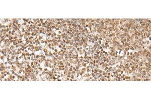 Immunohistochemistry of paraffin-embedded Human tonsil tissue using ZNF354A Polyclonal Antibody at dilution of 1:40(x200) (ZNF354A 抗体)