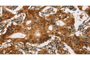 Immunohistochemistry (Paraffin-embedded Sections) (IHC (p)) image for anti-Calcium Channel, Voltage-Dependent, L Type, alpha 1C Subunit (CACNA1C) antibody (ABIN7238732)