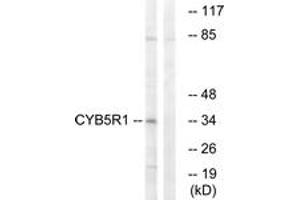 Western blot analysis of extracts from RAW264. (CYB5R1 抗体  (AA 9-58))