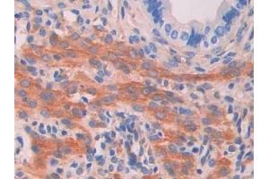 Detection of MYLK in Mouse Uterus Tissue using Polyclonal Antibody to Myosin Light Chain Kinase (MYLK) (MYLK 抗体  (AA 1684-1884))