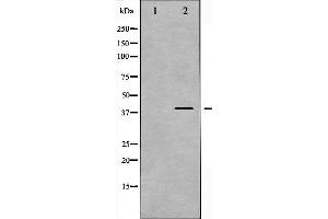 Western blot analysis of MKK3 phosphorylation expression in MDA-MB-435 whole cell lysates,The lane on the left is treated with the antigen-specific peptide. (MAP2K3 抗体  (pSer189))
