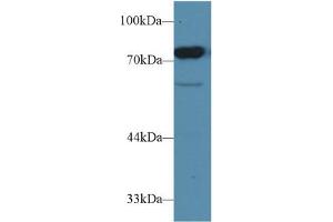Western blot analysis of Rat Testis lysate, using Rat CD2AP Antibody (1 µg/ml) and HRP-conjugated Goat Anti-Rabbit antibody ( (CD2AP 抗体  (AA 368-623))