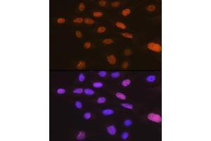 Immunofluorescence analysis of U-2 OS cells using T Rabbit mAb (ABIN7270729) at dilution of 1:100 (40x lens).